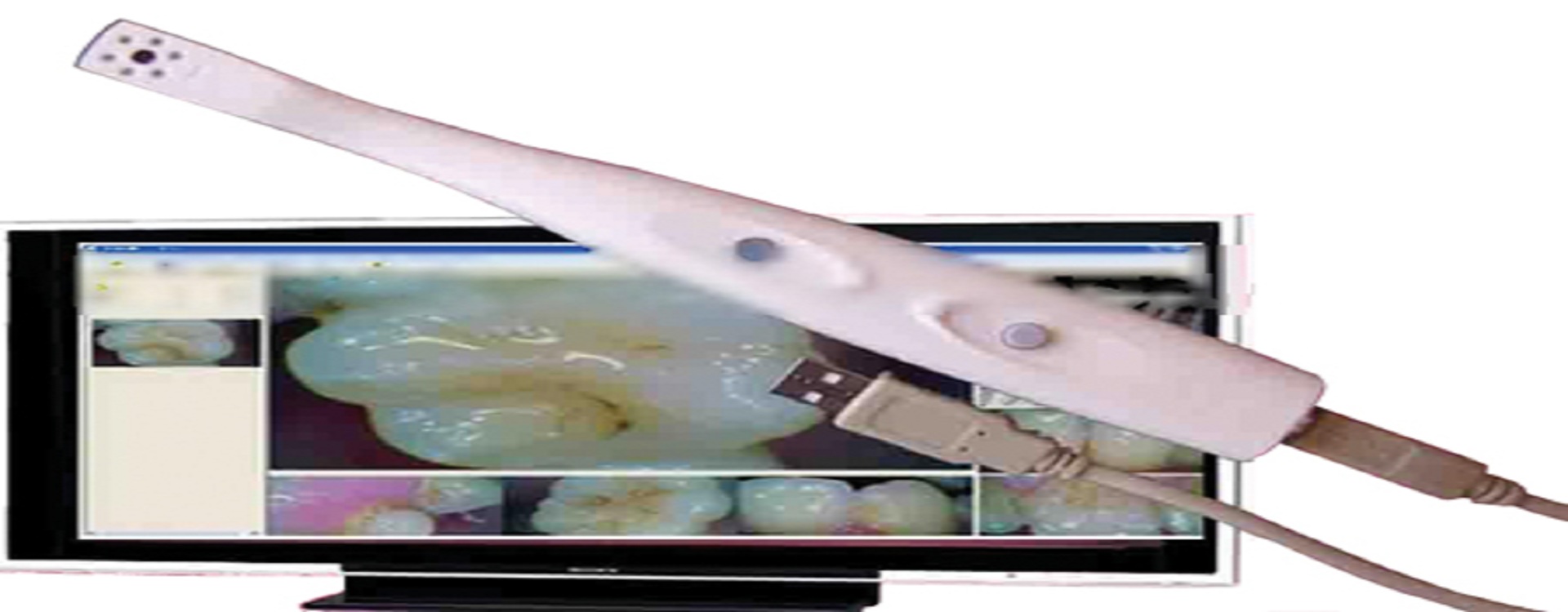 Best dental treatment in vibhuti khand lko