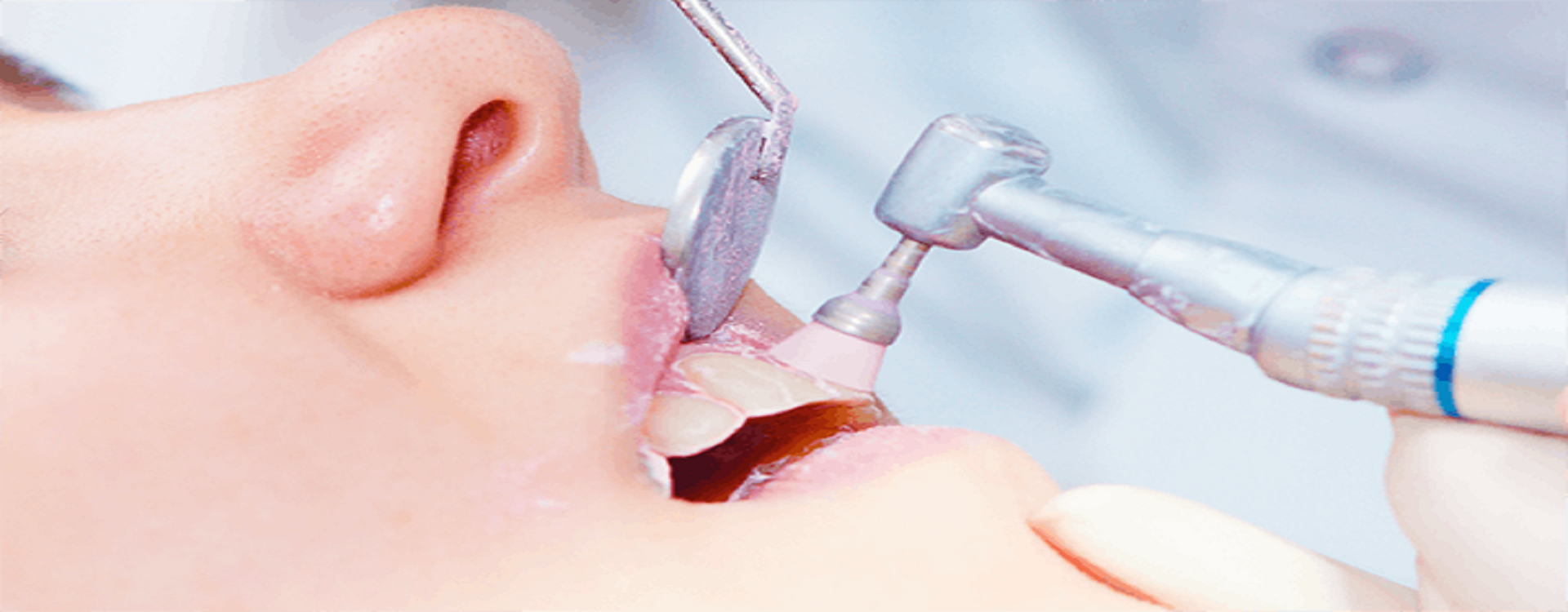 Best Dental clinic in gomti nagar extension