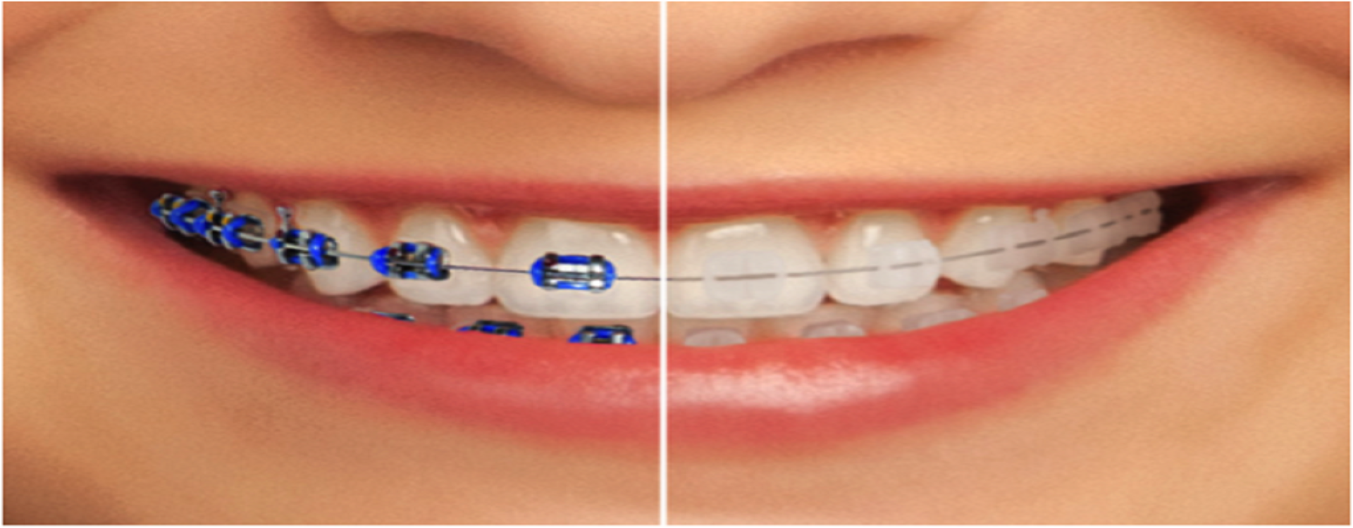 Best dental clinic near shaheed path lucknow