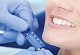 Smile Hub Superspeciality Dental & Maxillofacial Clinic