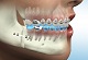 Smile Hub Superspeciality Dental & Maxillofacial Clinic