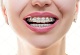 Smile Hub Superspeciality Dental & Maxillofacial Clinic